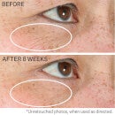 nia24 eye repair complex