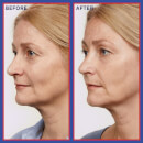 revitalift night serum retinol